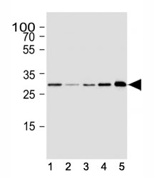 Western blot analysis of lysate from human (1) SH-SY5Y, (2) SK-BR-3, (3) HeLa cell line, (4) mouse brain and (5) rat brain tissue lysate using CDK5 antibody at 1:1000.
