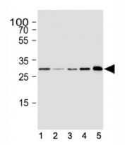 Western blot analysis of lysate from human (1) SH-SY5Y, (2) SK-BR-3, (3) HeLa cell line, (4) mouse brain and (5) rat brain tissue lysate using CDK5 antibody at 1:1000.