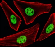Fluorescent image of human HeLa cells stained with SP1 antibody at 1:25 dilution. An Alexa Fluor 488-conjugated goat anti-mouse lgG was used as the secondary Ab (green). Cytoplasmic actin was counterstained with Alexa Fluor 555 conjugated with Phalloidin (red).