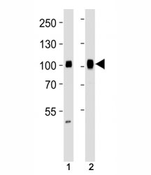 Western blot analysis of lysate from (1) HeLa and (2) Ramos cell line using SP1 antibody at 1:1000. Reported molecular weight: 81-95 kDa