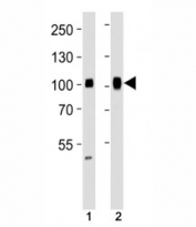Western blot analysis of lysate from human  (1) HeLa and (2) Ramos cell line using SP1 antibody at 1:1000. Reported molecular weight: 81-95 kDa.