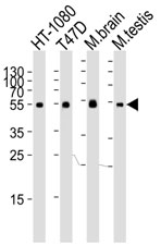 Western blot analysis of lysate from HT-1080, T47D cell line, mouse brain and testis tissue lysate using TUBA6 antibody at 1:1000.~