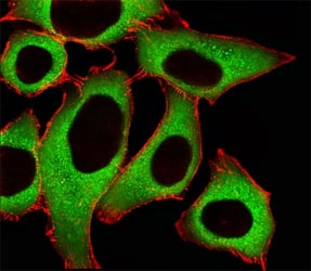 Fluorescent image of A549 cells stained with ALDH1A1 antibody at 1:25. An Alexa Fluor 488-conjugated goat anti-rabbit lgG was used as the secondary Ab (green). Cytoplasmic actin was counterstained with Alexa Fluor 555 conjugated with Phalloidin (red).~