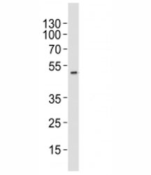 Western blot analysis of lysate from HT-29 cell line using AURKA antibody at 1:1000. Predicted molecular weight ~45 kDa.~