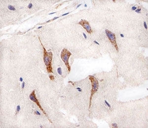 Immunohistochemical analysis of paraffin-embedded human brain using AURKA antibody at 1:25 dilution.