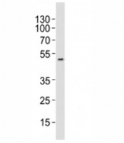 Western blot analysis of lysate from HT-29 cell line using AURKA antibody at 1:1000. Predicted molecular weight ~45 kDa.