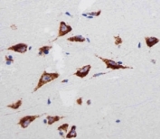 Immunohistochemical analysis of paraffin-embedded human brain section using RPS6 antibody at 1:25 dilution.