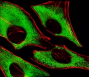 Fluorescent image of HeLa cells stained with RPS6 antibody at 1:25 dilution. An Alexa Fluor 488-conjugated goat anti-mouse lgG was used as the secondary Ab (green). Cytoplasmic actin was counterstained with Alexa Fluor 555 conjugated with Phalloidin (red).