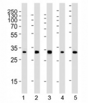 Western blot analysis of lysate from 1) 293, 2) HeLa, 3) mouse NIH3T3, 4) rat PC-12 and 5) rat brain tissue using RPS6 antibody at 1:2000. Predicted molecular weight ~29 kDa.