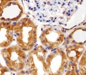 Immunohistochemical analysis of paraffin-embedded human kidney section using RPS6 antibody at 1:25 dilution.