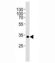 Western blot analysis of human recombinant protein using vWF antibody at 1:1000.