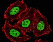Fluorescent image of HeLa cells stained with GLI2 antibody diluted at 1:25 dilution. An Alexa Fluor 488-conjugated goat anti-rabbit lgG was used as the secondary Ab (green). Cytoplasmic actin was counterstained with Alexa Fluor 555 conjugated with Phalloidin (red).