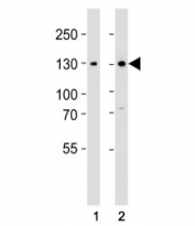 Western blot analysis of lysate from (1) 293 and (2) Jurkat cell line using GLI2 antibody at 1:1000. Predicted molecular weight: 86~168 kDa (multiple isoforms)(1).