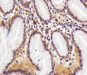Immunohistochemical analysis of paraffin-embedded human stomach section using RAC1 antibody at 1:25 dilution.