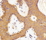 Immunohistochemical analysis of paraffin-embedded human skin section using RAC1 antibody at 1:25 dilution.