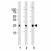 Western blot analysis of lysate from (1) human A431, (2) mouse NIH3T3, (3) rat C6 cell line using RAC1 antibody at 1:1000.