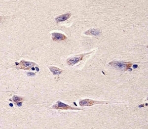 Immunohistochemical analysis of paraffin-embedded human brain section using DHFR antibody; Ab was diluted at 1:25 dilution.