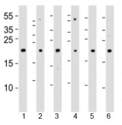 Western blot analysis of lysate from 1) 293T, 2) HeLa, 3) Jurkat, 4) Y79 cell line , 5) mouse spleen and 6) rat kidney tissue lysate using DHFR antibody at 1:1000. Predicted molecular weight ~22 kDa.