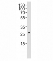 Western blot analysis of lysate from RD cell line (human rhabdomyosarcoma) using NRG1 antibody at 1:1000. Predicted molecular weight of multiple isofoms: 26-70 kDa.