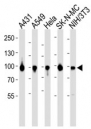 Western blot analysis of lysate from A431, A549, HeLa, SK-N-MC, mouse NIH3T3 cell line using HSP90 antibody diluted at 1:1000 for each lane.