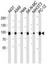 Western blot analysis of lysate from A431, A549, HeLa, SK-N-MC, mouse NIH3T3, rat PC-12 cell line using HSP-90 antibody diluted at 1:1000 for each lane.
