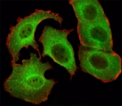 Immunohistochemical analysis of paraffin-embedded human skeletal muscle section using SMAD1 antibody; Ab was diluted at 1:25 dilution.