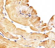 Immunohistochemical analysis of paraffin-embedded human skeletal muscle section using SMAD1 antibody; Ab was diluted at 1:25 dilution.