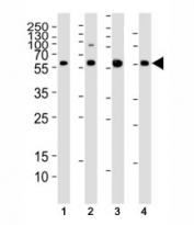 Western blot analysis of lysate from (1) HT-1080, (2) HUVEC, (3) mouse C2C12 cell line and (4) rat liver tissue using SMAD1 antibody at 1:1000. Predicted molecular weight: 52~60 kDa.
