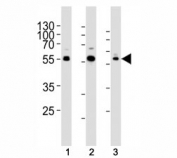 Western blot analysis of lysate from human (1) Jurkat, (2) PC3, and rat (3) C6 cells using AKT1/2/3 antibody at 1:1000. Predicted molecular weight: ~56kDa.