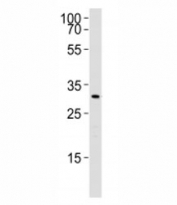 Western blot analysis of lysate from rat liver using Cebpb antibody. Ab was diluted at 1:1000. Predicted molecular weight: ~33/33/36-41 kDa (rat/mouse/human).