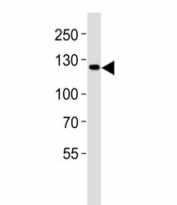Western blot analysis of lysate from LNCaP cell line using JAK2 antibody diluted at 1:1000. Predicted molecular weight ~130 kDa
