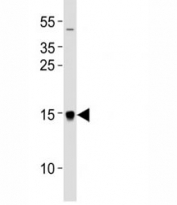 Western blot analysis of lysate from U87-MG cell line using MAP1LC3A antibody at 1:1000.