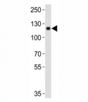 Western blot analysis of lysate from mouse kidney tissue lysate using DDR1 antibody diluted at 1:1000. Predicted molecular weight: 100~125KD.