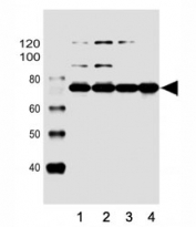 Western blot analysis of lysate from human (1) Raji, (2) Ramos, (3) K562 cell line and (4) mouse spleen tissue lysate using BTK antibody at 1:1000.