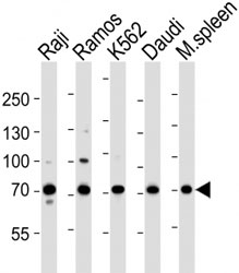 Western blot analysis of lysate from Raji, Ramos, K562, Daudi cell line and mouse spleen tissue lysate using BTK antibody at 1:1000.~