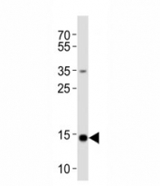 Western blot analysis of lysate from HeLa cell line using FIS1 antibody diluted at 1:1000.