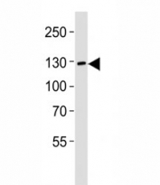 Western blot analysis of lysate from LNCaP cell line using JAK2 antibody diluted at 1:1000. Predicted molecular weight ~130 kDa
