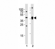 Western blot analysis of (1) zebrafish brain and (2) whole zebrafish tissue lysate using Ada antibody. Ab was diluted at 1:1000 for each lane.