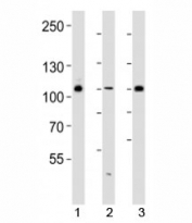 Western blot analysis of lysate from 293, HUVEC, T47D cell line (left to right) using GAB1 antibody diluted at 1:1000 for each lane. Predicted molecular weight ~76 kDa, also observed at 100-110 kDa.