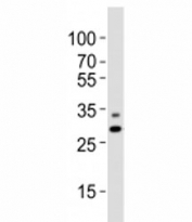 Western blot analysis of lysate from A431 cell line using PHB antibody diluted at 1:1000. Predicted molecular weight ~29 kDa.