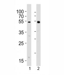 Western blot analysis of lysate from 1) human Raji cell line and 2) rat spleen tissue lysate using Lyn antibody. Predicted molecular weight 56/58 kDa (isoforms 1/2).
