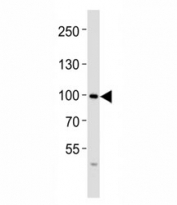 Western blot analysis of lysate from SW480 cell line using FGFR4 antibody at 1:1000. Observed molecular weight: 88~125 kDa depending on phosphorylation and glycosylation level.