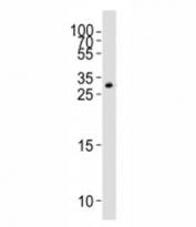Western blot analysis of lysate from HT-1080 cell line using GDF15 antibody; Ab was diluted at 1:1000. Predicted molecular weight ~34 kDa (pro-form) and ~25 kDa (mature form).