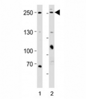 Western blot analysis of lysate from 1) HeLa and 2) MCF-7 cell line using MUC4 antibody; Ab was diluted at 1:1000 for each lane.