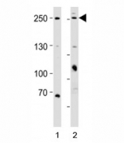 Western blot analysis of lysate from 1) HeLa and 2) MCF-7 cell line using MUC4 antibody; Ab was diluted at 1:1000 for each lane.