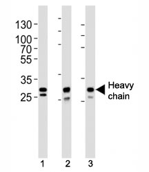 Western blot analysis of lysate from (1) A431, (2) MCF-7, (3) SK-BR-3 cell line using Cathepsin D antibody at 1:1000. Predicted molecular weight of heavy chain: ~28 kDa.