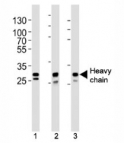 Western blot analysis of lysate from (1) A431, (2) MCF-7, (3) SK-BR-3 cell line using Cathepsin D antibody at 1:1000. Expected molecular weight: 43-46 kDa, 28 kDa (heavy chain), 15 kDa (light chain).