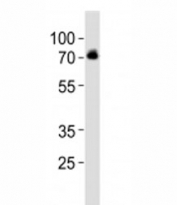 Western blot analysis of lysate from SH-SY5Y cell line using DBH antibody at 1:1000. Predicted molecular weight ~69kDa.