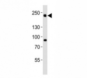 Western blot analysis of lysate from HeLa cell line using Dnmt1 antibody diluted at 1:1000. Predicted molecular weight: 180-200 kDa