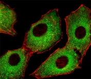 Fluorescent image of A549 cells stained with CDK5 antibody at 1:25 dilution. An Alexa Fluor 488-conjugated goat anti-rabbit lgG was used as the secondary Ab (green). Cytoplasmic actin was counterstained with Alexa Fluor 555 conjugated with Phalloidin (red).